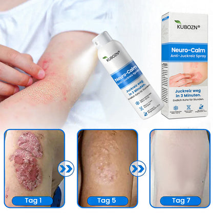 3-Minuten Linderung⚡KUBOZN® Magnesium Kräuter-Spray für Psoriasis-neigende Haut