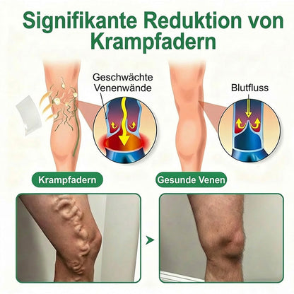 👨‍⚕️🔥Healrize® VeinEase Mikronadel-Technologie⚡Spürbare Wirkung in Tagen – nachhaltige Verbesserung