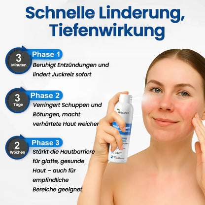 3-Minuten Linderung⚡KUBOZN® Magnesium Kräuter-Spray für Psoriasis-neigende Haut
