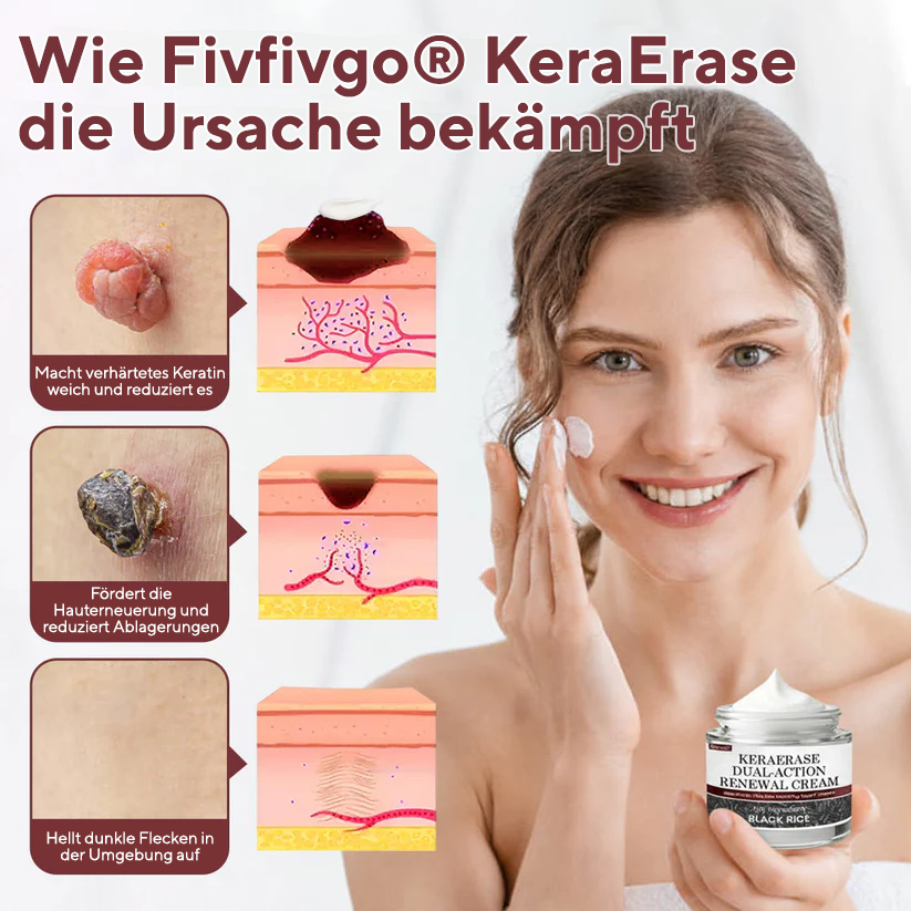 Cvreoz® KeraErase Dual-Action Erneuerungscreme (offer)