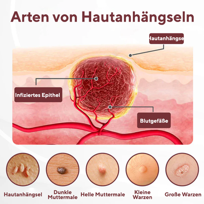 Cvreoz® KeraErase Dual-Action Erneuerungscreme (offer)