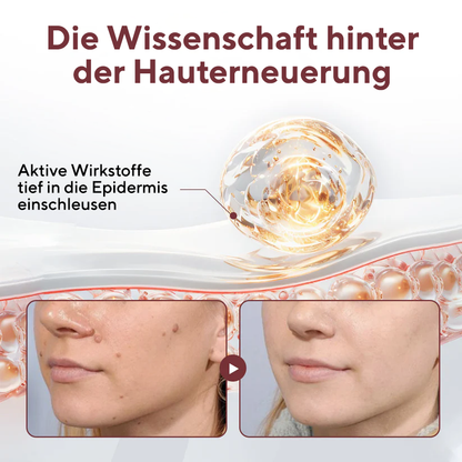 Cvreoz® KeraErase Dual-Action Erneuerungscreme (offer)