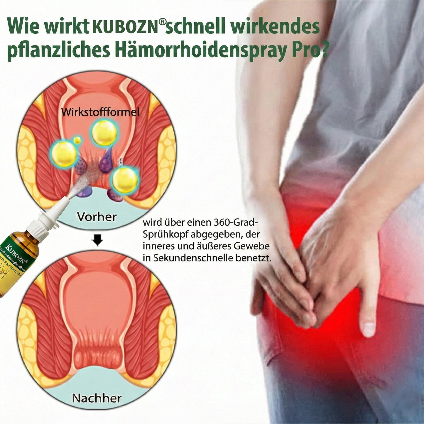 KUBOZN® Pflanzliches Hämorrhoiden-Sofort-Spray Pro